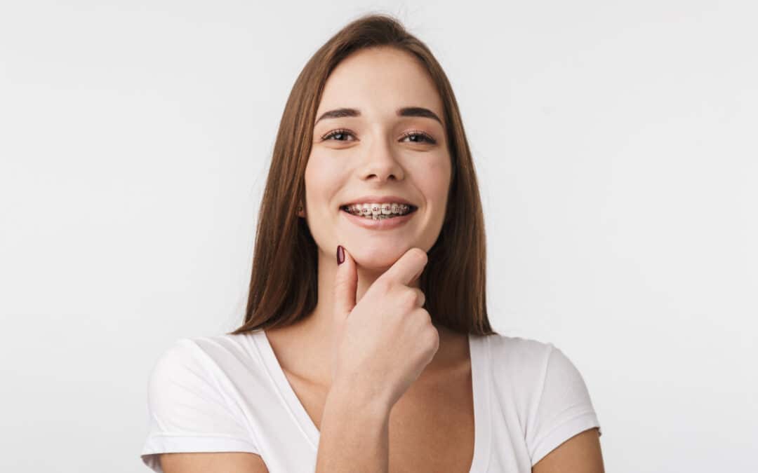 Aparelho dentário fixo: Saiba quando e como usar!