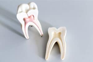 dor e desvitalização dentária